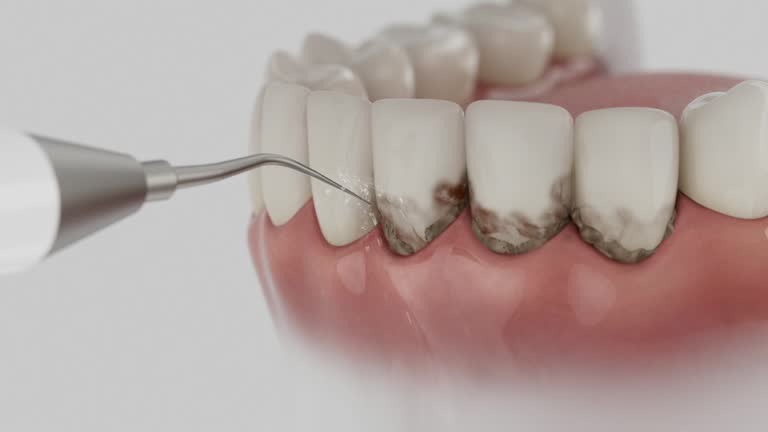 Reliable Dental contractor in Winchester, OH by Dentist Open Now